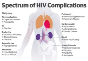 Common issues for people with HIV