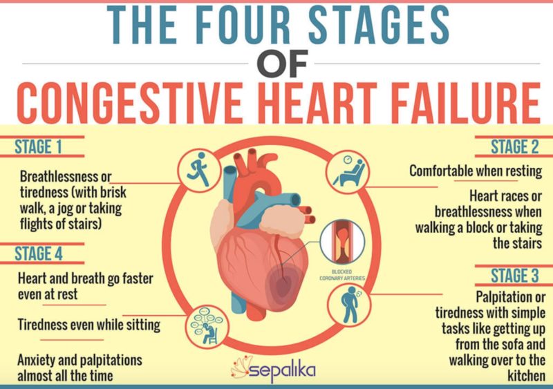 Stages of congestive heart failure